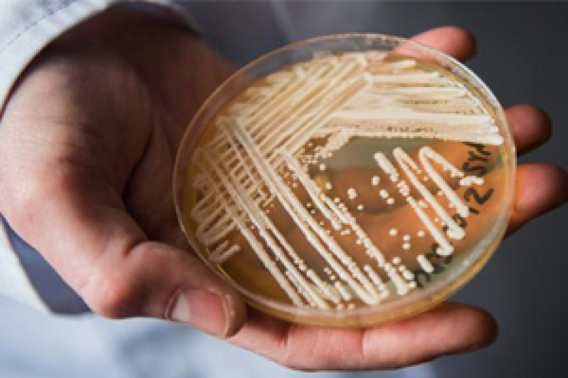 Brasil registra su primer posible caso de raro y potencialmente fatal hongo "Candida auris"