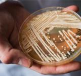 Brasil registra su primer posible caso de raro y potencialmente fatal hongo "Candida auris"