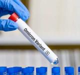 Reportaron 191 muertos y 102.458 nuevos contagios de coronavirus en la Argentina