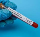 Estudian ocho casos sospechosos de hepatitis graves de origen desconocido en niños y niñas