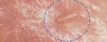 El problema de los diminutos ácaros que tienen sexo en nuestras caras