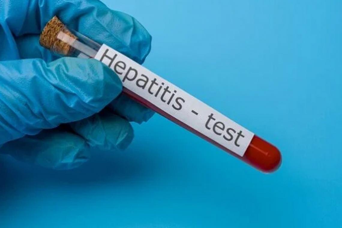 10 PREGUNTAS SOBRE LAS HEPATITIS VIRALES
