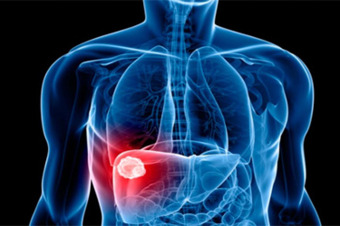 HEPATITIS C: EN LA ACTUALIDAD SOLO UN BAJO NÚMERO DE PACIENTES ES DIAGNOSTICADO EN AMÉRICA LATINA