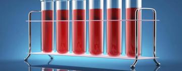 Podría ayudar a detectar el cáncer, un nuevo análisis de sangre