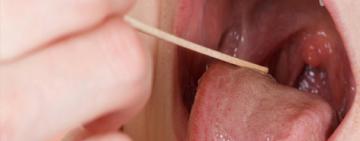 De qué se trata el estreptococo que ya causó 78 muertes en Argentina