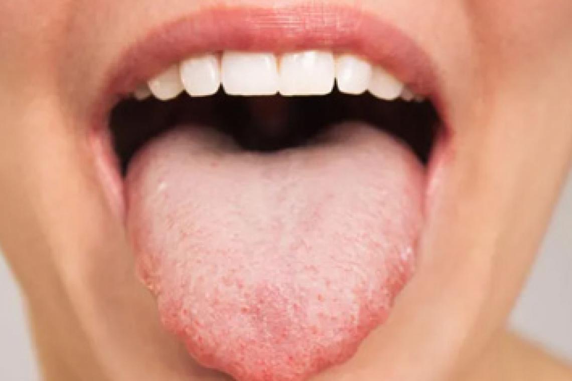 Cómo el patrón único de tu lengua puede influir en qué alimentos te gustan