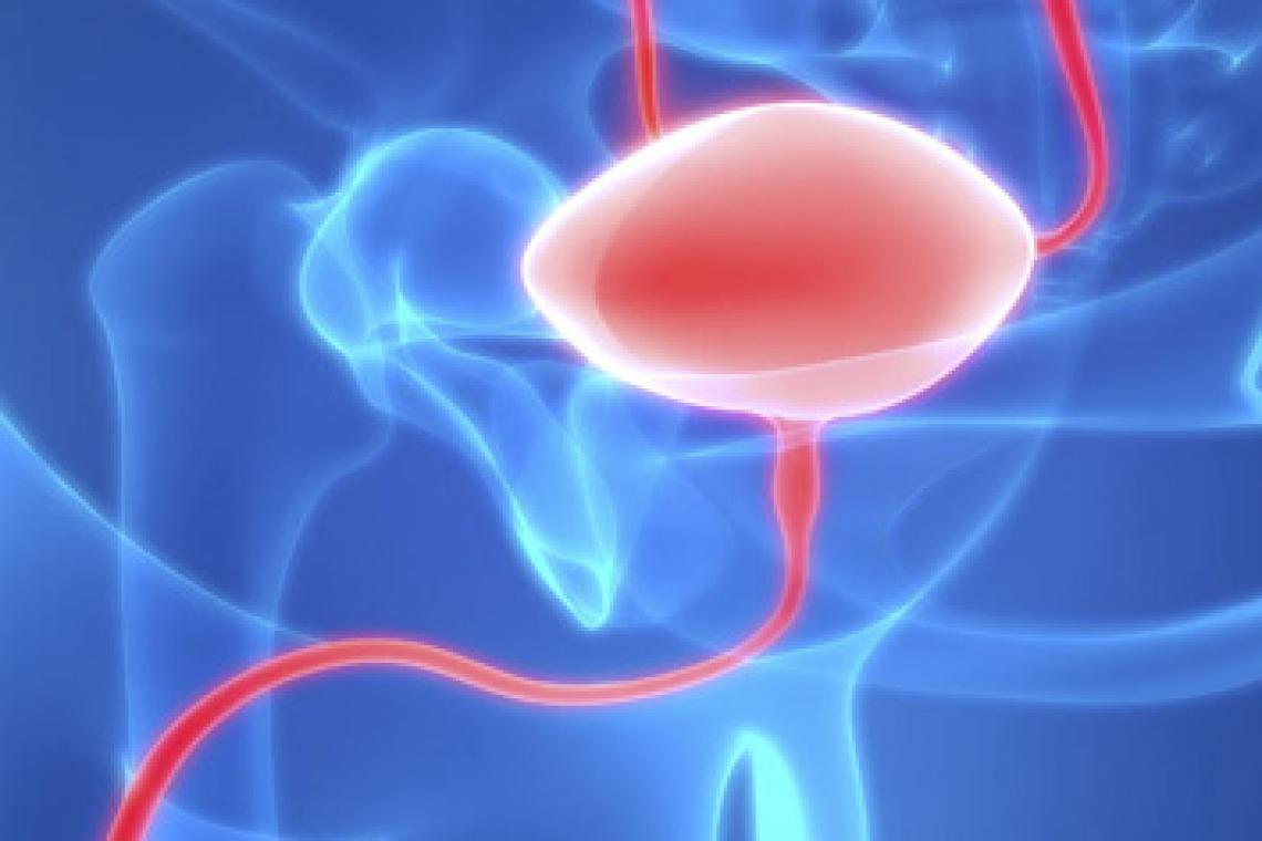 Día Mundial del cáncer de vejiga: casi 4 mil argentinos son diagnosticados por año