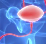 Día Mundial del cáncer de vejiga: casi 4 mil argentinos son diagnosticados por año