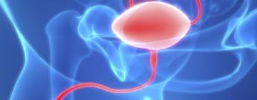 Día Mundial del cáncer de vejiga: casi 4 mil argentinos son diagnosticados por año