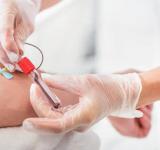 La Municipalidad pone en marcha un cronograma especial de testeos de VIH y sífilis