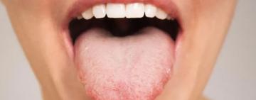 Cómo el patrón único de tu lengua puede influir en qué alimentos te gustan