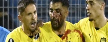 Un jugador de Peñarol recibió un corte tras ser agredido por un hincha de Rosario Central