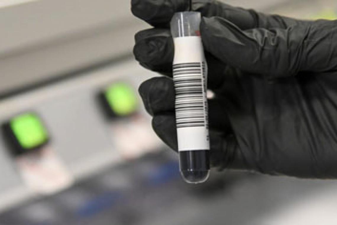 Estudios genéticos de cáncer