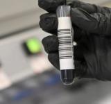 Estudios genéticos de cáncer