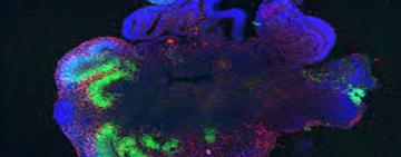 Científicos desarrollan “mini cerebros” humanos para alimentar computadoras