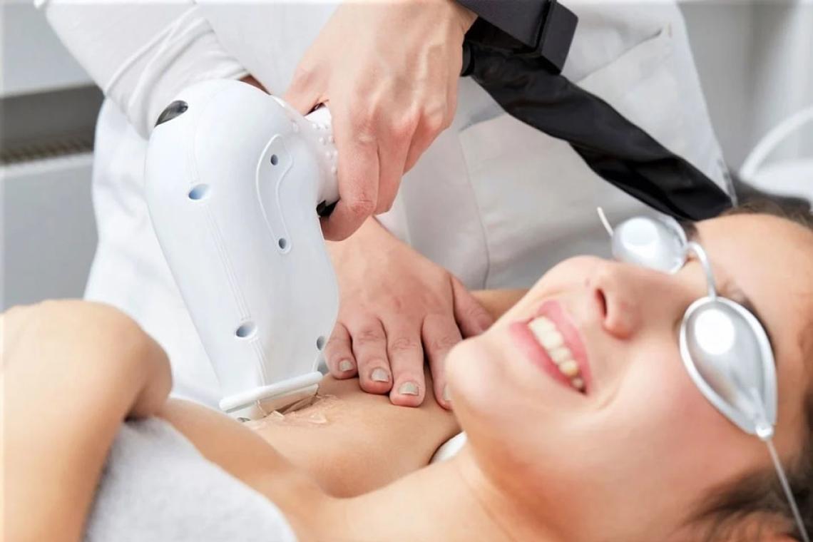 Depilación láser: qué efectos tiene en la piel y qué tan segura es